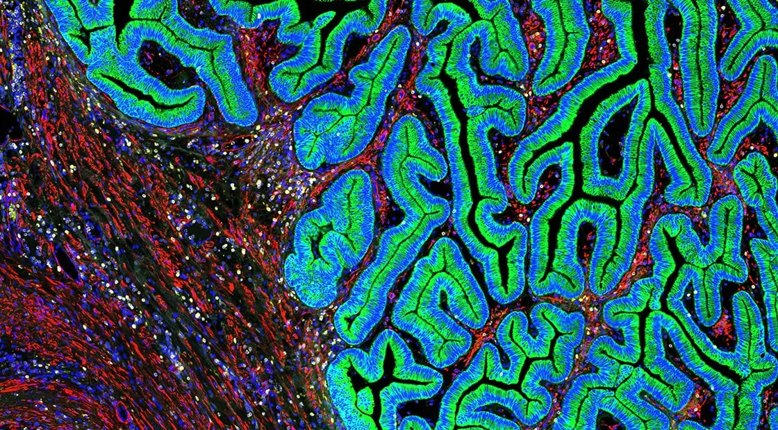 Multiplexed Protein Analysis