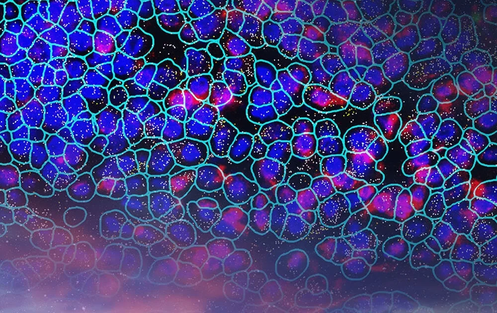 Tissue Imaging and Analysis